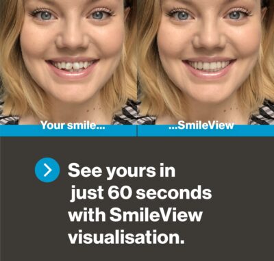 Invisalign™ Treatment - Cygnet House Dental