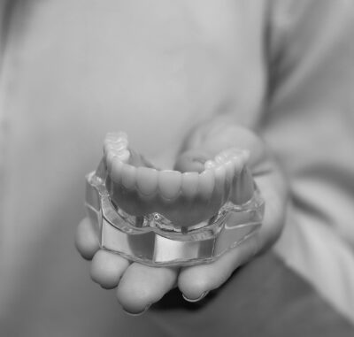 Implant Retained Dentures - Cygnet House Dental