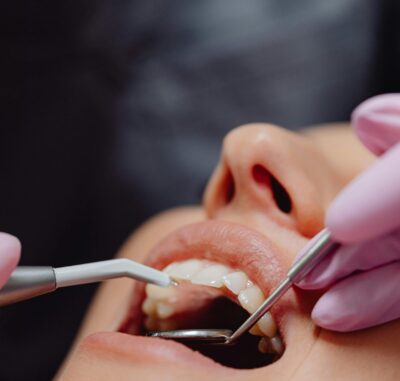 Mouth Cancer Screening - Cygnet House Dental